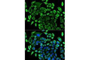 Immunofluorescence analysis of U2OS cells using T antibody (ABIN6131955, ABIN6148795, ABIN6148796 and ABIN6221421). (TAB1 antibody  (AA 205-504))