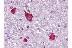 Immunohistochemical staining of Brain (Neurons and glia) using anti- PTHR2 antibody ABIN122363
