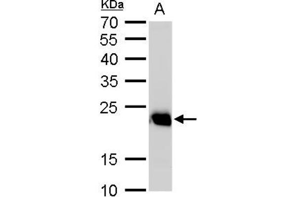 RAB6A antibody
