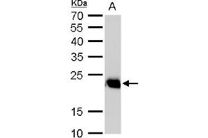 WB Image RAB6A antibody detects RAB6A protein by western blot analysis.