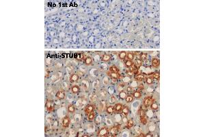 Immunohistochemistry (IHC) image for anti-STIP1 Homology and U-Box Containing Protein 1 (STUB1) antibody (ABIN6254206)