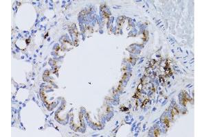 Immunohistochemistry of paraffin-embedded rat lung using RARA antibody. (Retinoic Acid Receptor alpha antibody)