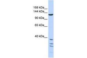 Image no. 1 for anti-Tankyrase, TRF1-Interacting Ankyrin-Related ADP-Ribose Polymerase (TNKS) (AA 1079-1128) antibody (ABIN6740351) (TNKS antibody  (AA 1079-1128))
