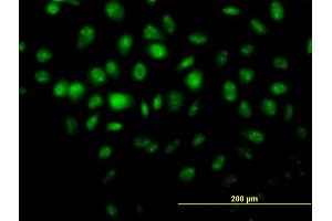 Immunofluorescence (IF) image for anti-Histone Deacetylase 8 (HDAC8) (AA 1-377) antibody (ABIN527747)