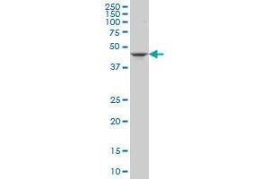 GSDML monoclonal antibody (M06), clone 4C10 Western Blot analysis of GSDML expression in Jurkat . (Gasdermin B antibody  (AA 1-411))