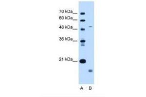 Image no. 1 for anti-Zinc Metalloproteinase, Ste24 (Zmpste24) (AA 83-132) antibody (ABIN6738260) (ZMPSTE24 antibody  (AA 83-132))