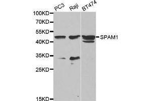 Western blot analysis of extracts of various cell lines, using SPAM1 antibody. (SPAM1 antibody  (AA 100-300))