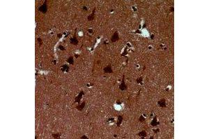 Immunohistochemical analysis of Alpha-synuclein (pY125) staining in human brain formalin fixed paraffin embedded tissue section. (SNCA antibody  (C-Term, pTyr125))