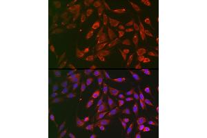 Immunofluorescence (IF) image for anti-Tumor Necrosis Factor Receptor Superfamily, Member 1A (TNFRSF1A) (AA 22-211) antibody (ABIN1513619)