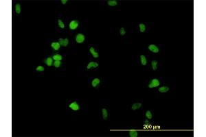 Immunofluorescence of monoclonal antibody to CSE1L on HeLa cell. (Exportin 2 antibody  (AA 872-971))