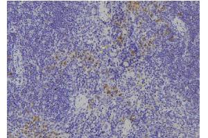 ABIN6268882 at 1/100 staining Human spleen tissue by IHC-P. (Fibronectin 1 antibody  (C-Term))
