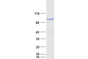 Validation with Western Blot (NUMB Protein (Transcript Variant 2) (Myc-DYKDDDDK Tag))