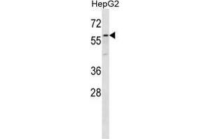 ZP4 Antibody (C-term) western blot analysis in HepG2 cell line lysates (35 µg/lane). (ZP4 antibody  (C-Term))