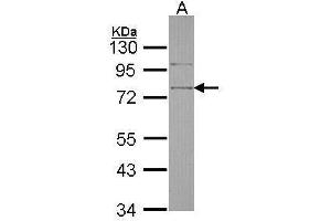 WB Image Sample (30 ug of whole cell lysate) A: Hela 10% SDS PAGE antibody diluted at 1:1000 (SRPX antibody)