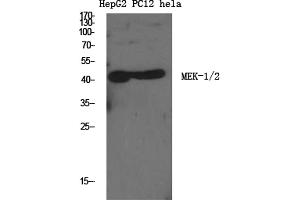 Western Blotting (WB) image for anti-Mitogen-Activated Protein Kinase Kinase 1/2 (MAP2K1/2) (Ser222), (Ser226) antibody (ABIN5961680) (MEK1/2 antibody  (Ser222, Ser226))