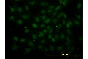 Immunofluorescence of monoclonal antibody to GABPA on HeLa cell. (GABPA antibody  (AA 1-100))
