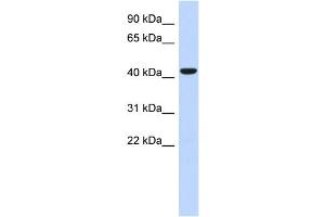 WB Suggested Anti-SGMS2 Antibody Titration: 0. (Sphingomyelin Synthase 2 antibody  (N-Term))