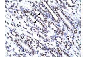 G22P1 antibody was used for immunohistochemistry at a concentration of 4-8 ug/ml to stain Epithelial cells of renal tubule (arrows) in Human Kidney. (XRCC6 antibody  (N-Term))