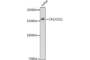 Western blot analysis of extracts of Jurkat cells, using CR2/CD21 antibody (ABIN1678995, ABIN3015431, ABIN3015432 and ABIN7101406) at 1:1000 dilution. (CD21 antibody)