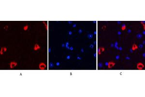 Immunofluorescence analysis of mouse brain tissue. (MAP2 antibody)