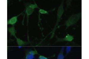 Immunofluorescence analysis of U-251 MG cells using FABP7 Polyclonal Antibody at dilution of 1:100. (FABP7 antibody)