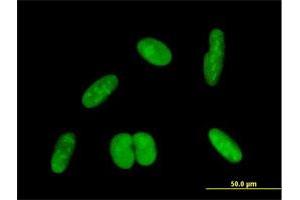 Immunofluorescence of purified MaxPab antibody to ZNF169 on HepG2 cell. (ZNF169 antibody  (AA 1-590))