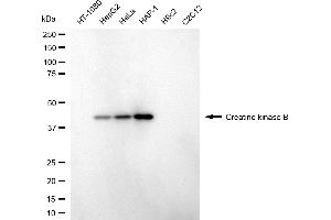 Western blotting analysis using creatine kinase B antibody (ABIN7798160).