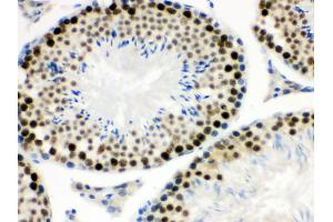 Immunohistochemistry (IHC) image for anti-Menage A Trois Homolog 1, Cyclin H Assembly Factor (Xenopus Laevis) (MNAT1) (AA 92-278) antibody (ABIN3043583)