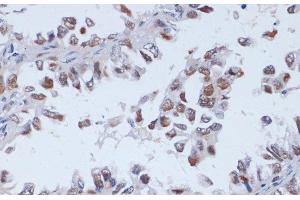 Immunohistochemistry (Paraffin-embedded Sections) (IHC (p)) image for anti-DNA (Cytosine-5-)-Methyltransferase 3 Like (TRDMT1) antibody (ABIN7260352)