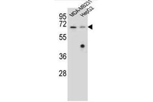 Western blot analysis of  Glomulin Antibody (C-term) in MDA-MB231, HepG2 cell line lysates (35ug/lane). (GLMN antibody  (C-Term))