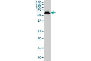 USP14 monoclonal antibody (M04), clone 6D6 Western Blot analysis of USP14 expression in HeLa . (USP14 antibody  (AA 395-494))