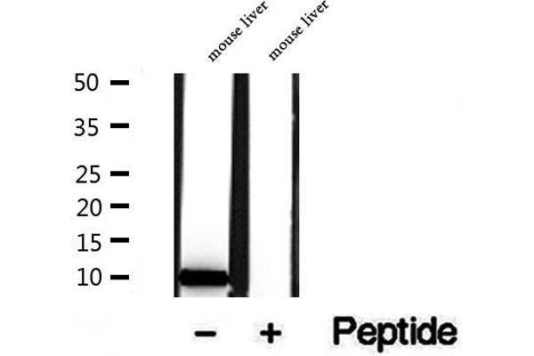 TIMM9 antibody  (C-Term)