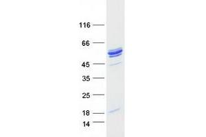 Validation with Western Blot (NAT6 Protein (Myc-DYKDDDDK Tag))