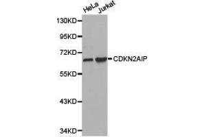 Western Blotting (WB) image for anti-CDKN2A Interacting Protein (CDKN2AIP) antibody (ABIN1871760)