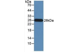 Detection of Recombinant GZMM, Human using Monoclonal Antibody to Granzyme M (GZMM) (GZMM antibody  (AA 26-257))