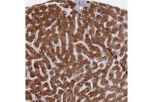Immunohistochemical staining of human liver with ZNF844 polyclonal antibody  shows strong cytoplasmic positivity in hepatocytes at 1:50-1:200 dilution. (ZNF844 antibody)