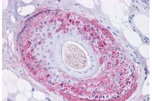 Anti-Ghrelin Receptor antibody  ABIN1048650 IHC staining of human skin, hair follicle. (GHSR antibody  (Internal Region))