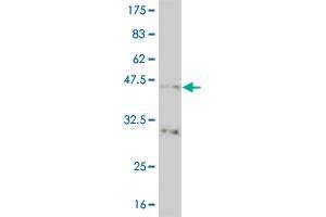 Western Blot detection against Immunogen (40. (NK2 Homeobox 5 antibody  (AA 1-130))