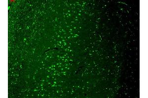 Immunohistochemistry analysis using Mouse Anti-TrpV3 Monoclonal Antibody, Clone S15-4 . (TRPV3 antibody  (AA 774-791) (Biotin))