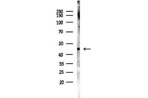 anti-Arrestin Domain Containing 3 (ARRDC3) (C-Term) antibody