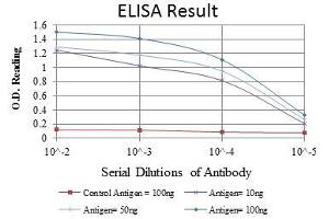 Red: Control Antigen (100 ng), Purple: Antigen (10 ng), Green: Antigen (50 ng), Blue: Antigen (100 ng), (CDK9 antibody)