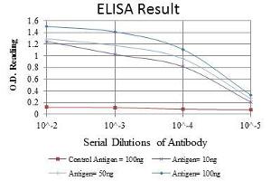 Red: Control Antigen (100 ng), Purple: Antigen (10 ng), Green: Antigen (50 ng), Blue: Antigen (100 ng), (CDK9 antibody)