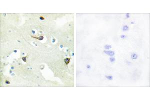 Peptide - + (EPH Receptor B1/2/3 (Internal Region) antibody)