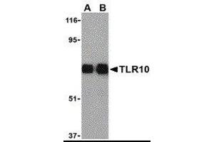 Western Blotting (WB) image for anti-Toll-Like Receptor 10 (TLR10) antibody (ABIN2479798) (TLR10 antibody)