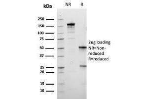 SDS-PAGE Analysis Purified Calbindin 1 Mouse Monoclonal Antibody (CALB1/3333). (CALB1 antibody  (AA 7-96))