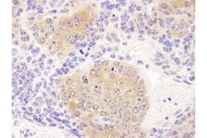 Immunohistochemistry (IHC) image for anti-Chaperonin Containing TCP1, Subunit 8 (Theta) (CCT8) (AA 398-448) antibody (ABIN7453619) (CCT8 antibody  (AA 398-448))