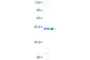 Image no. 1 for Fibroblast Growth Factor 21 (FGF21) (AA 30-209) protein (GST tag) (ABIN1354016) (FGF21 Protein (AA 30-209) (GST tag))