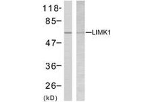 Western blot analysis of extracts from NIH-3T3 cells, treated with UV, using LIMK2 (Ab-505) Antibody. (LIMK2 antibody  (AA 471-520))