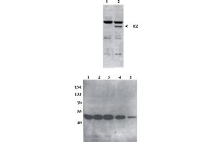 Western Blot testing of anti-BPV E2 DNaseI monoclonal antibody (5E11). (Bovine Papilloma Virus 1 E2 (BPV-1 E2) (AA 199-208) antibody)