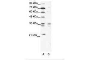 Image no. 1 for anti-BARX Homeobox 1 (BARX1) (AA 91-140) antibody (ABIN202088) (BARX1 antibody  (AA 91-140))